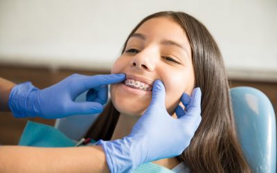 What is the Best Age for Braces?