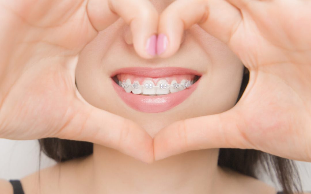 Advanced Orthodontics: What Sets it Apart from Traditional Care? 