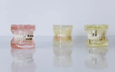 Your Guide to Handling Orthodontic Emergencies with Confidence